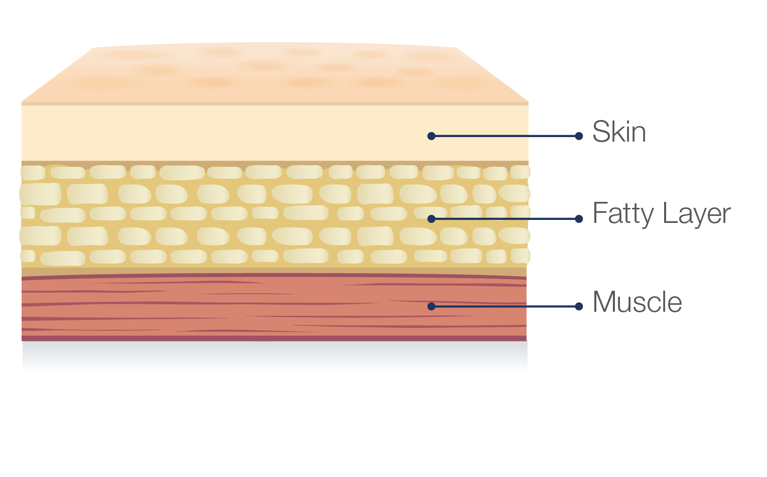 skin diagram